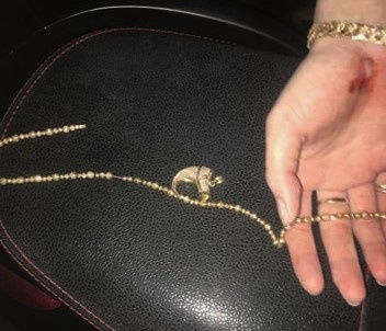 Tai xe taxi bat cuop anh 1