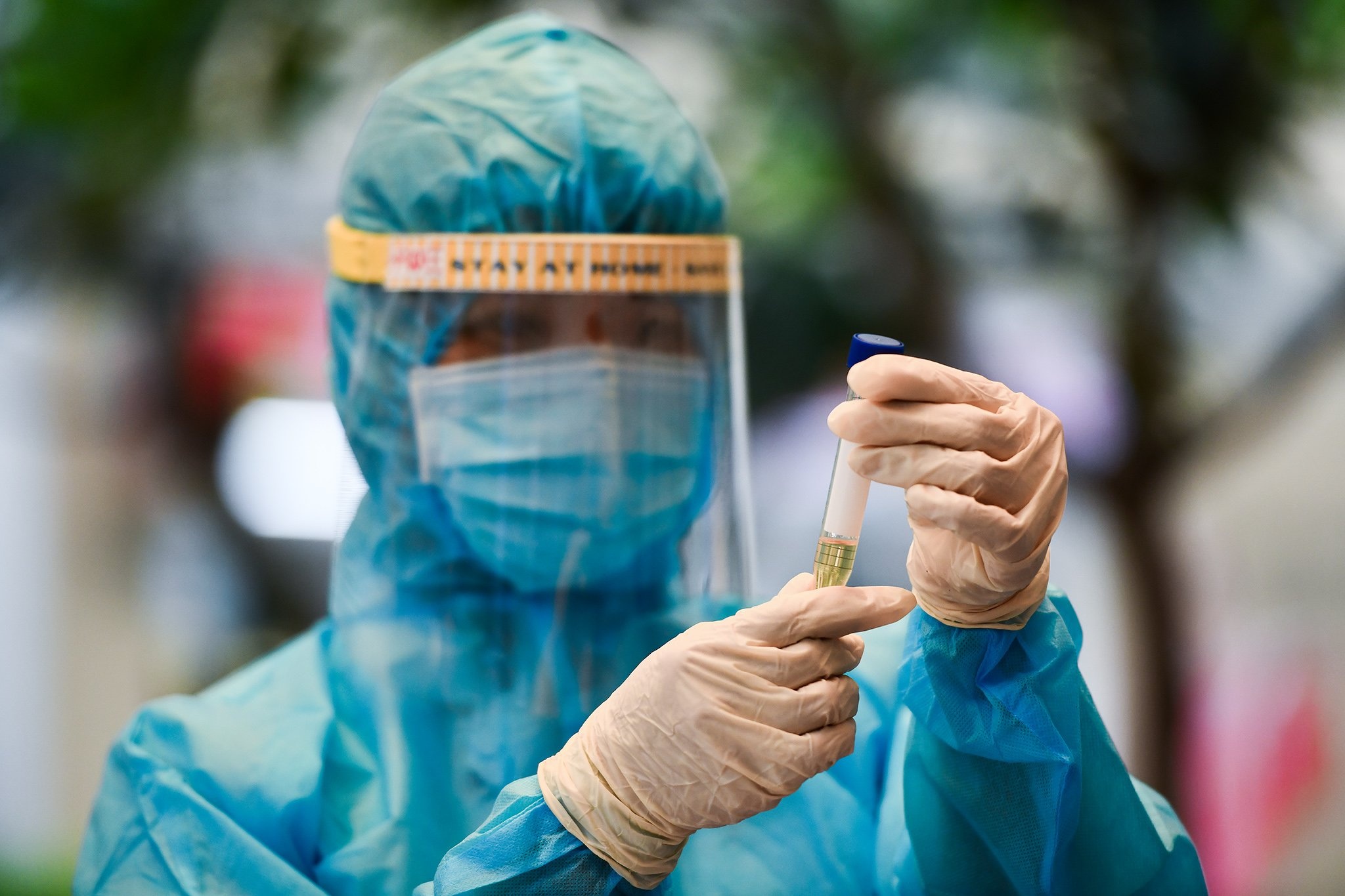 Phong toa chung cu TP Thu Duc anh 5