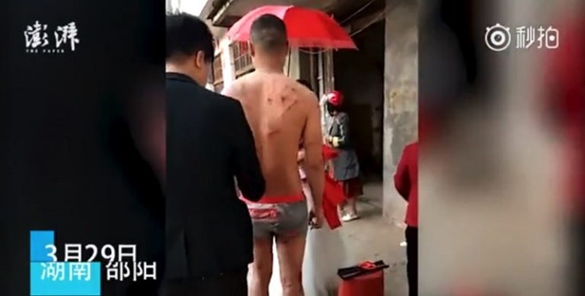 chu re bi choi kham anh 3