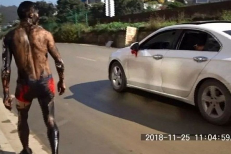 chu re bi choi kham anh 1