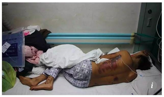 chu re bi choi kham anh 2