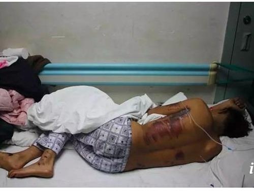 Chu re kien ban be vi bi nem trung, dam xe trong ngay cuoi hinh anh