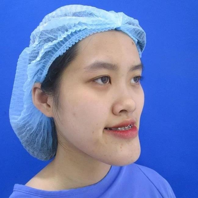 lot xac sau phau thuat tham my anh 1