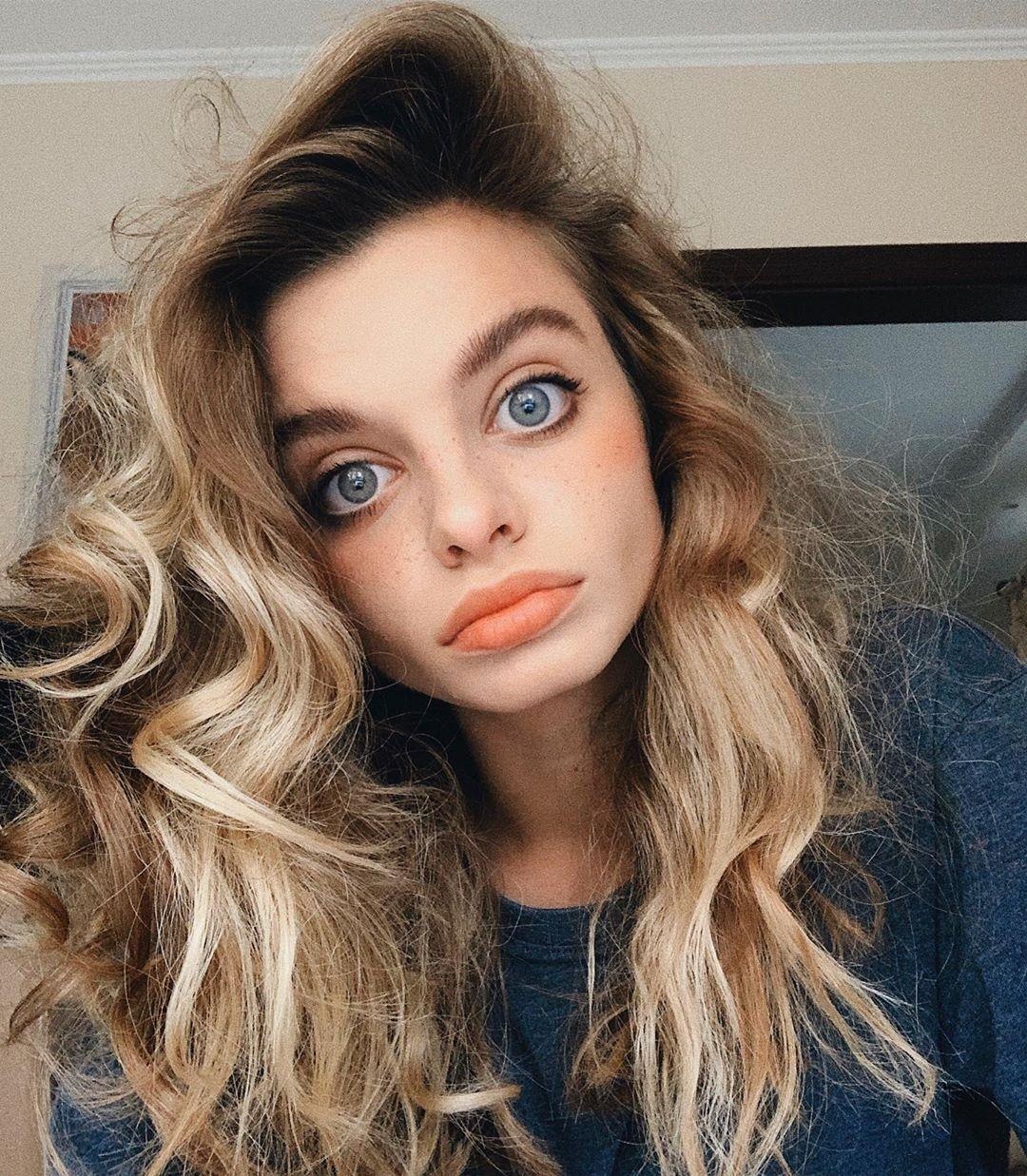 co gai co doi mat to bat thuong anh 2