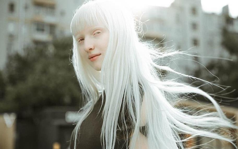 Ve ngoai cua 'mau nu bach tang xinh dep nhat the gioi' hinh anh