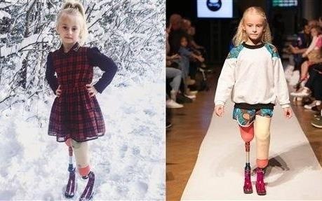 Co be 9 tuoi cut hai chan la mau nhi noi tieng the gioi hinh anh