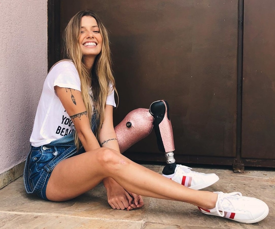 nguoi mau cut mot chan anh 1