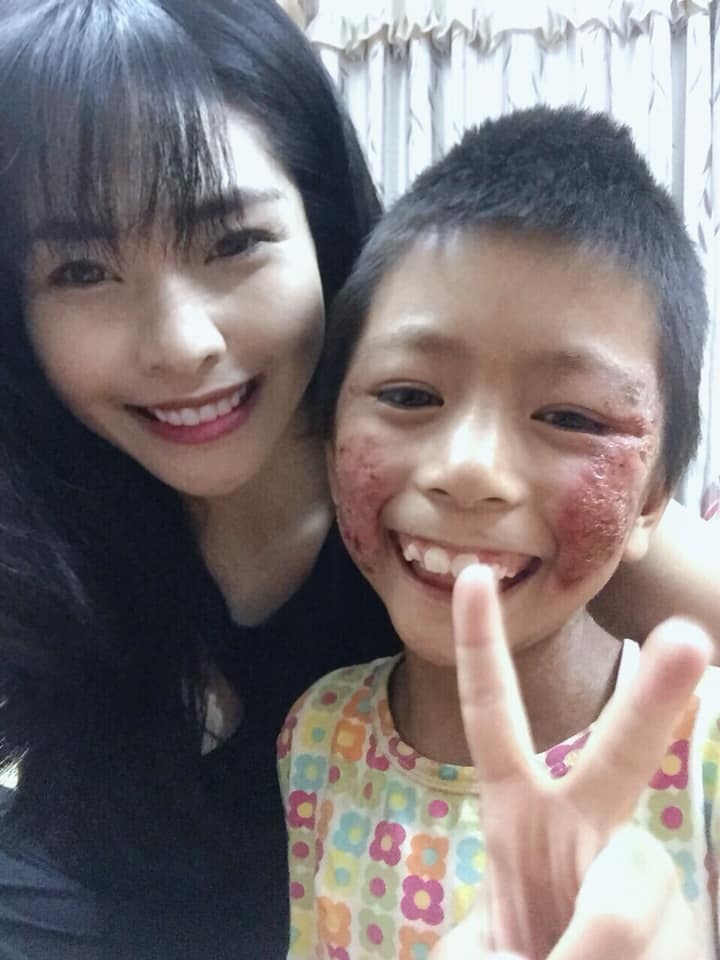 co gai xinh dep nhan nuoi be gai benh tat anh 2