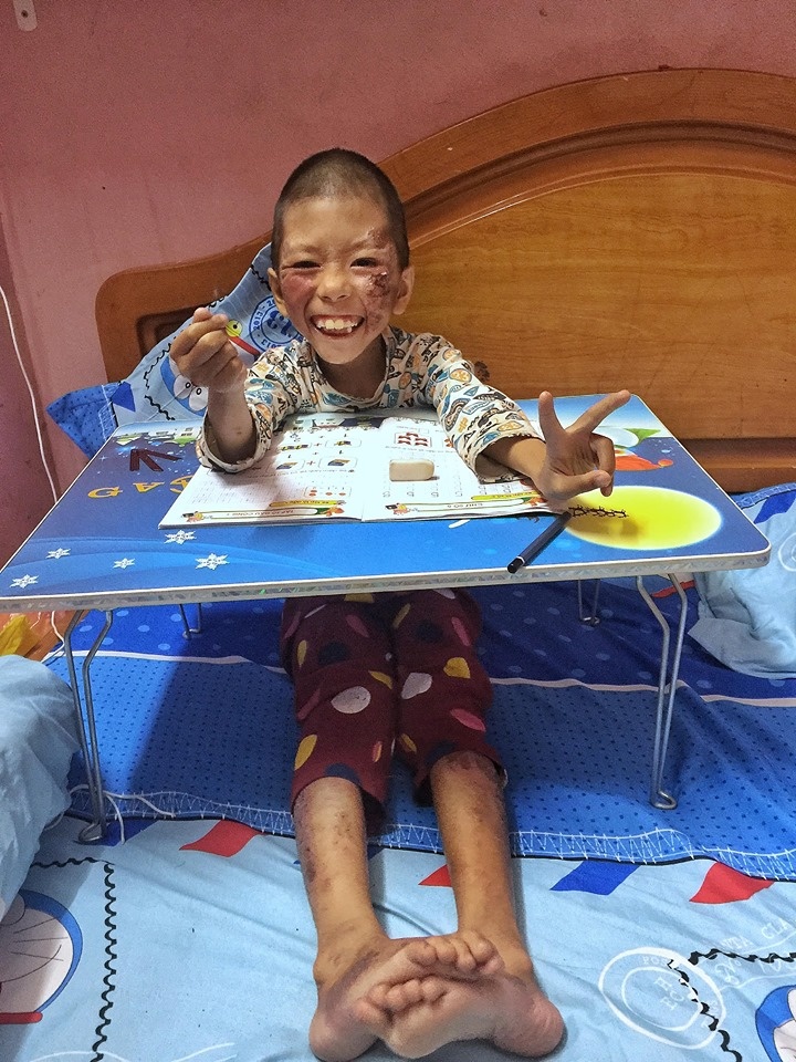 co gai xinh dep nhan nuoi be gai benh tat anh 3