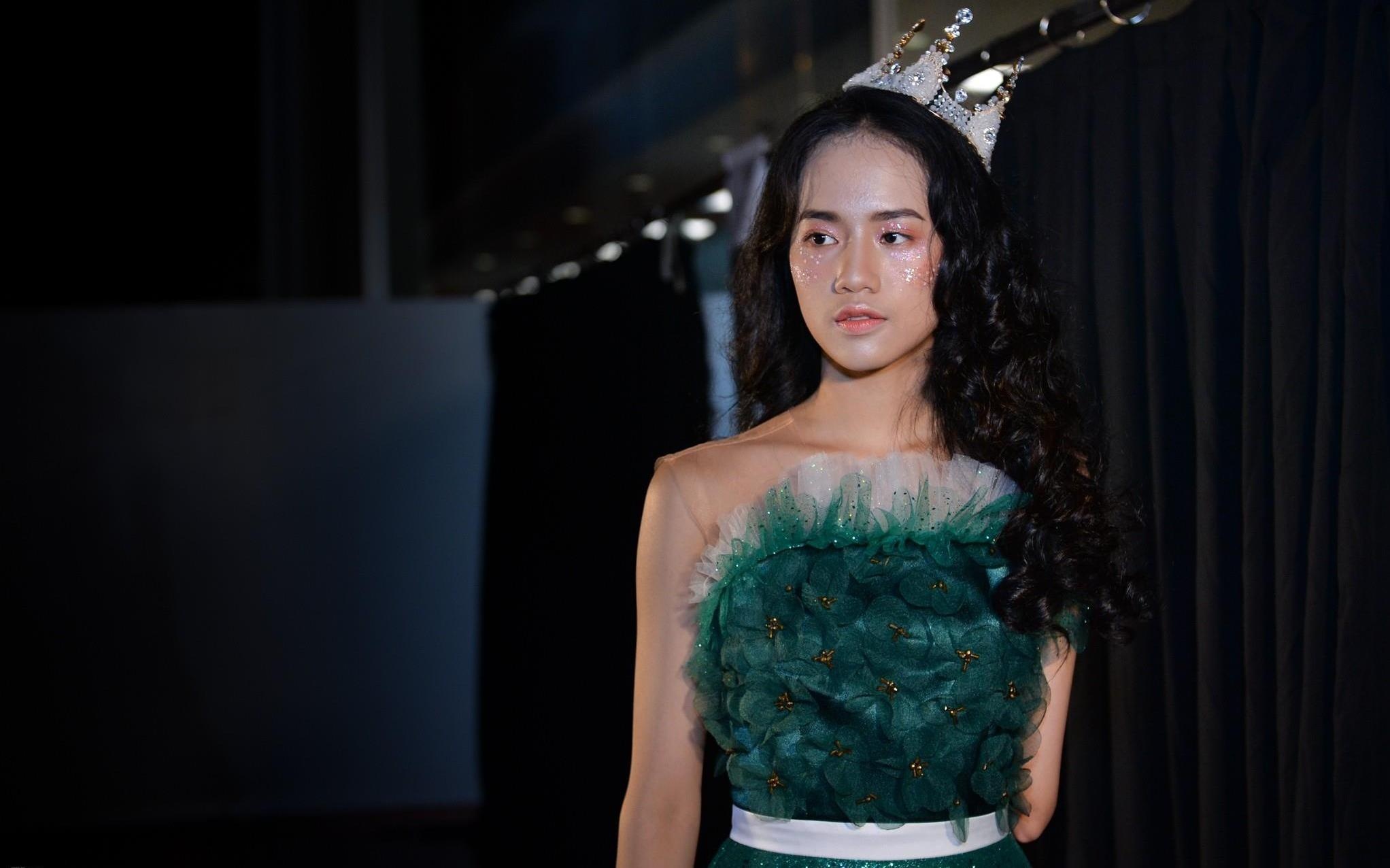 Nguoi mau 14 tuoi cut mot tay: 'Em da dam de lo khiem khuyet cua minh' hinh anh