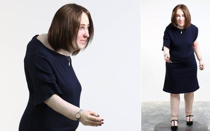 Dan van phong 20 nam nua lung gu, chan sung, mac nhieu benh nguy hiem hinh anh