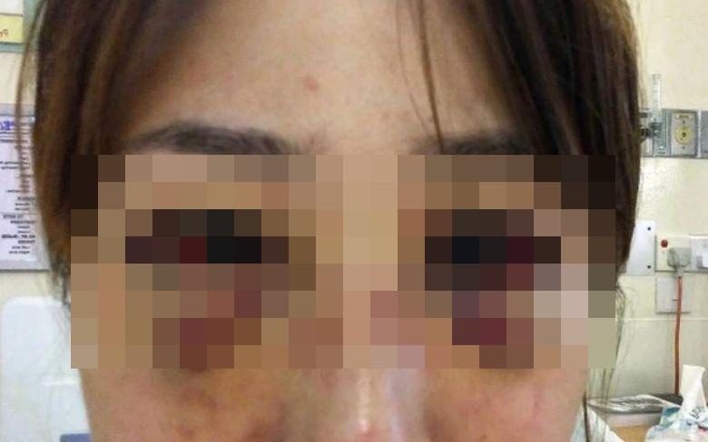 Bac si Singapore hanh hung ban gai vi bi tu choi quan he tinh duc hinh anh
