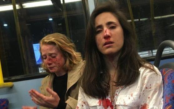 Xet xu 3 thanh nien Anh bat doi dong tinh nu hon nhau tren xe buyt hinh anh