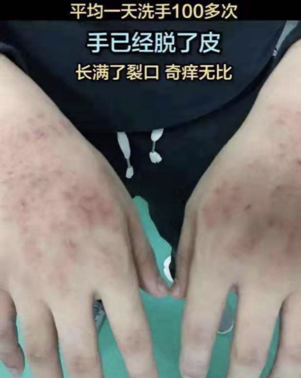 dịch virus corona ảnh 7 dich virus corona anh 7