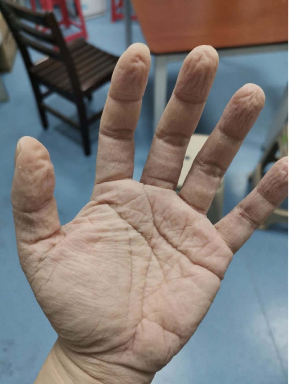 dịch virus corona ảnh 6 dich virus corona anh 6