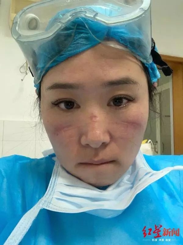 dich virus corona anh 1