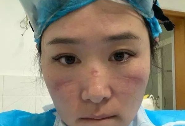 Ve nha an Tet mot ngay, bac si xin quay lai benh vien de chong dich hinh anh