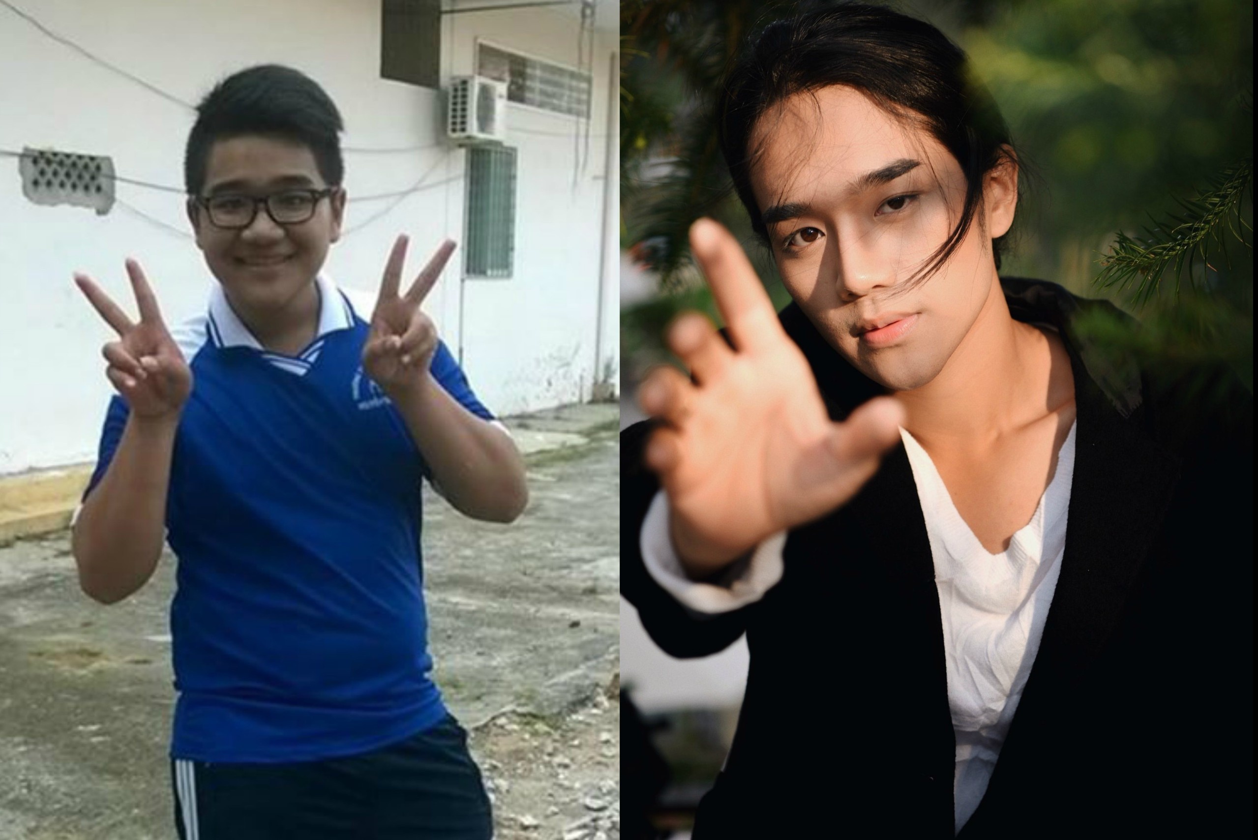 9X Kien Giang duoc khen la 'cuc pham' sau khi phau thuat va giam can hinh anh