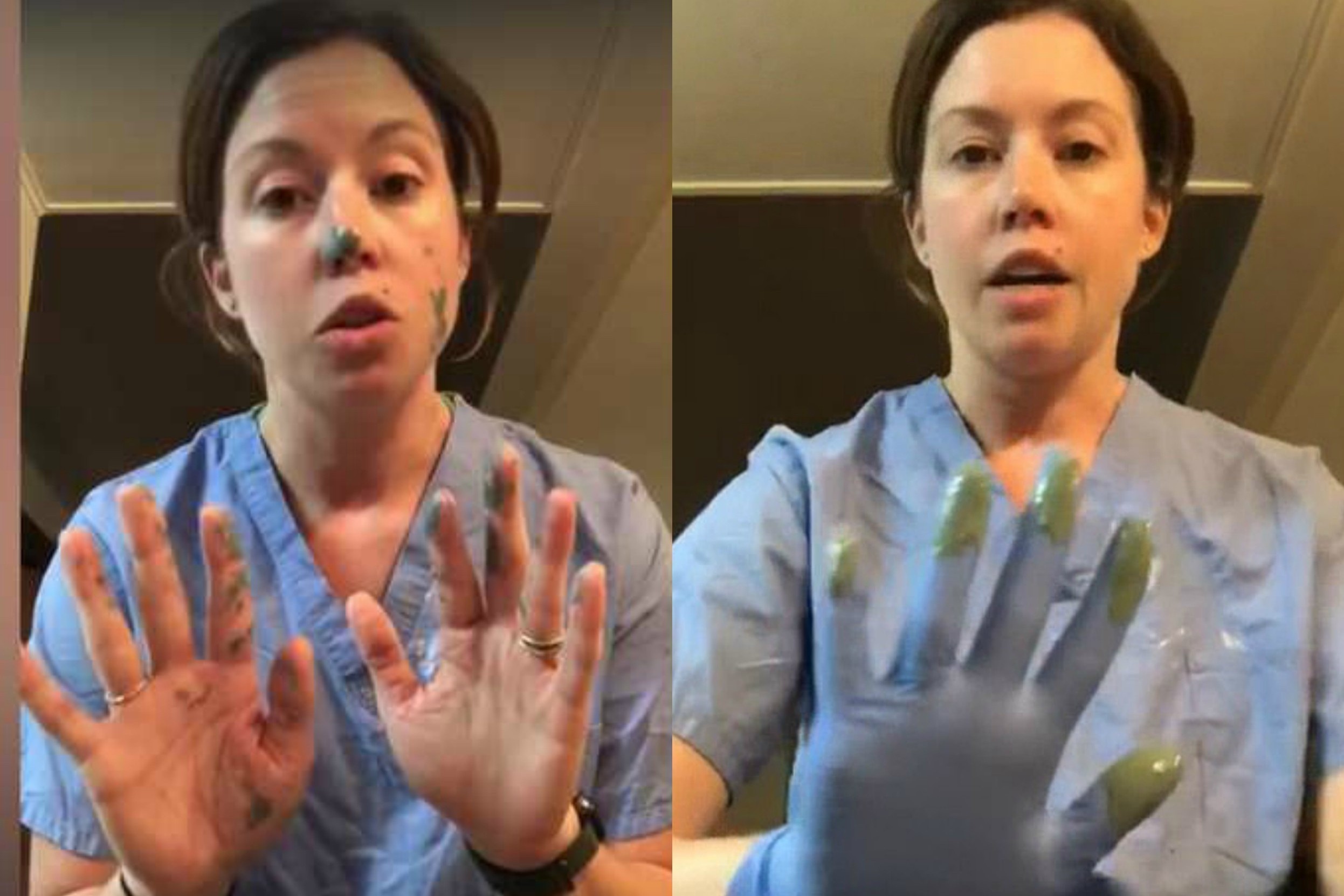 Y ta My: 'Deo gang tay ma khong rua lai cung vo ich truoc dich benh' hinh anh