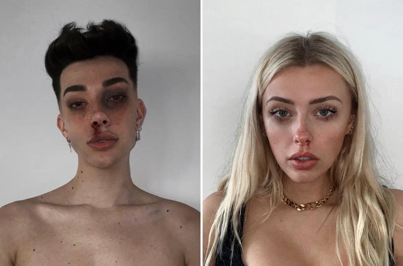 trao luu chup anh toi pham anh 2