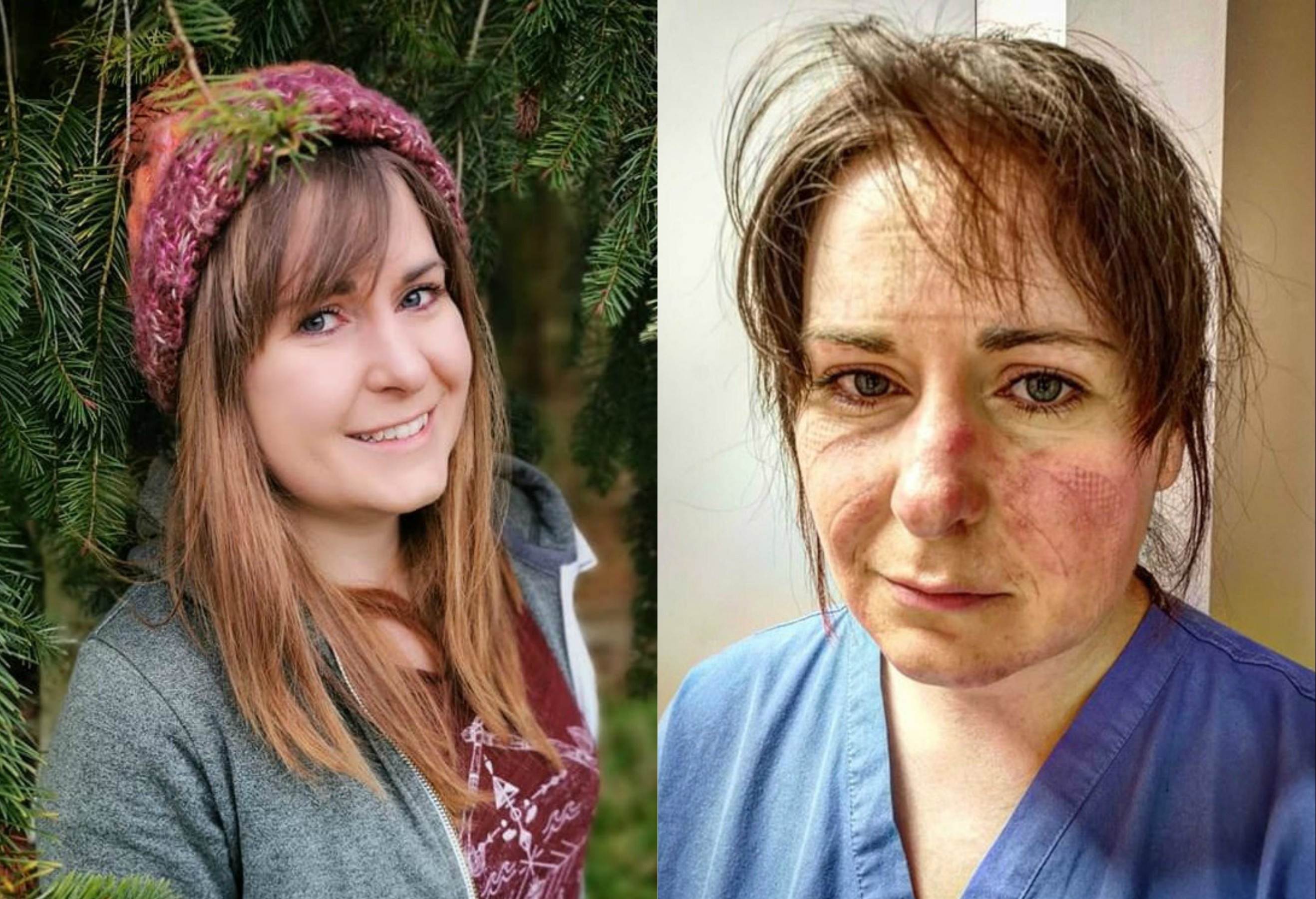 Guong mat bien dang, day am anh cua y ta Anh sau 13 tieng lam viec hinh anh