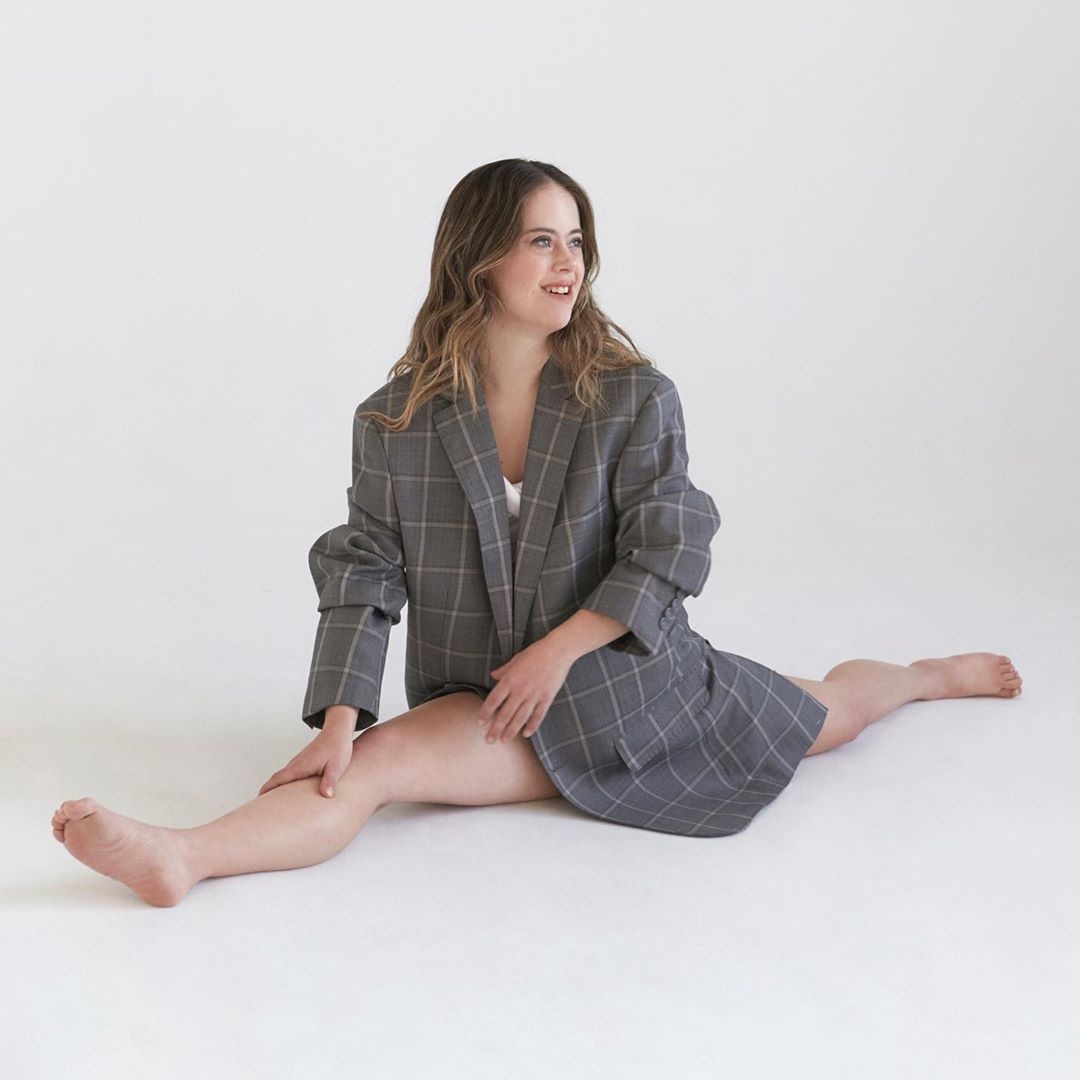 co gai mac benh down lam nguoi mau anh 3