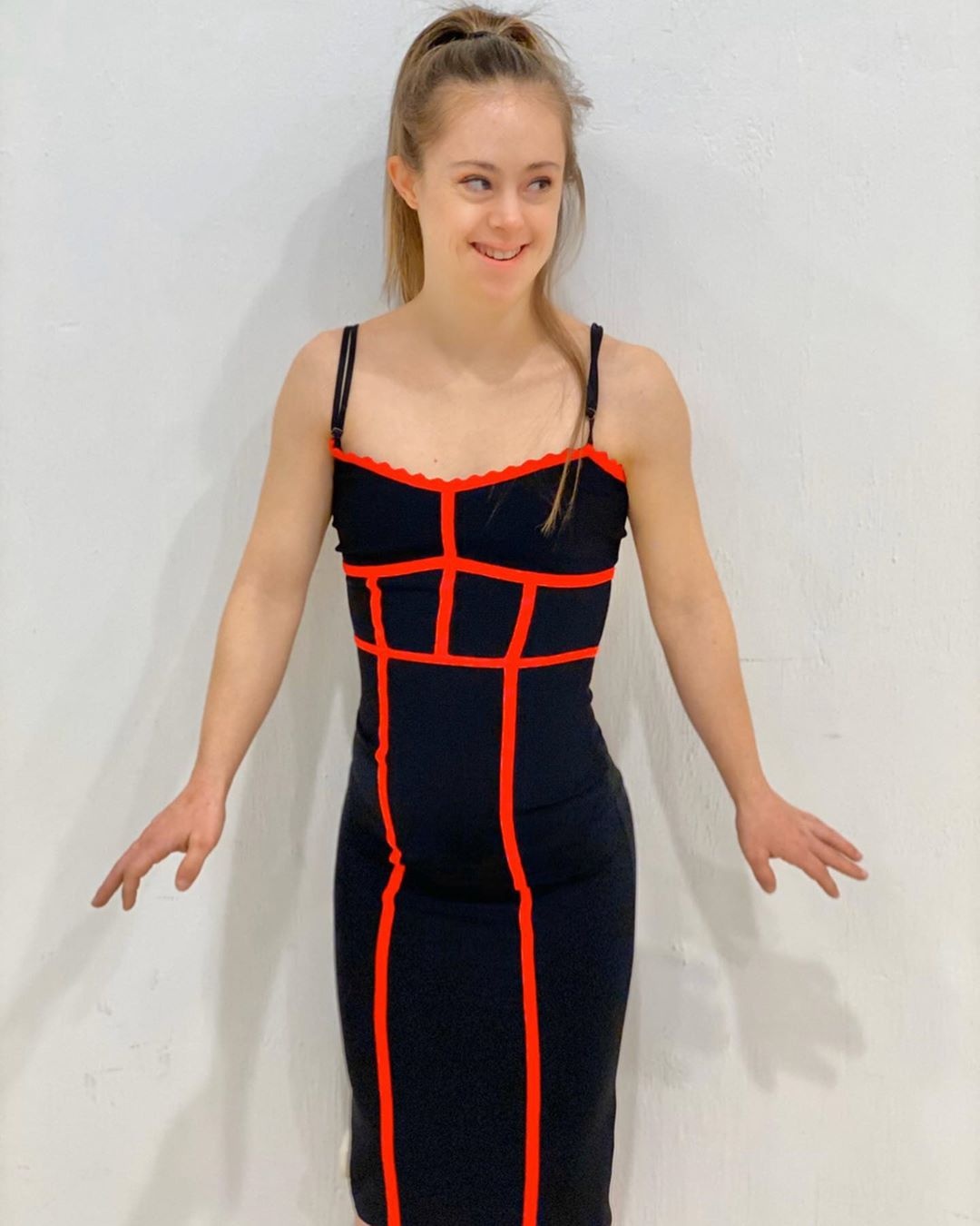 co gai mac benh down lam nguoi mau anh 9