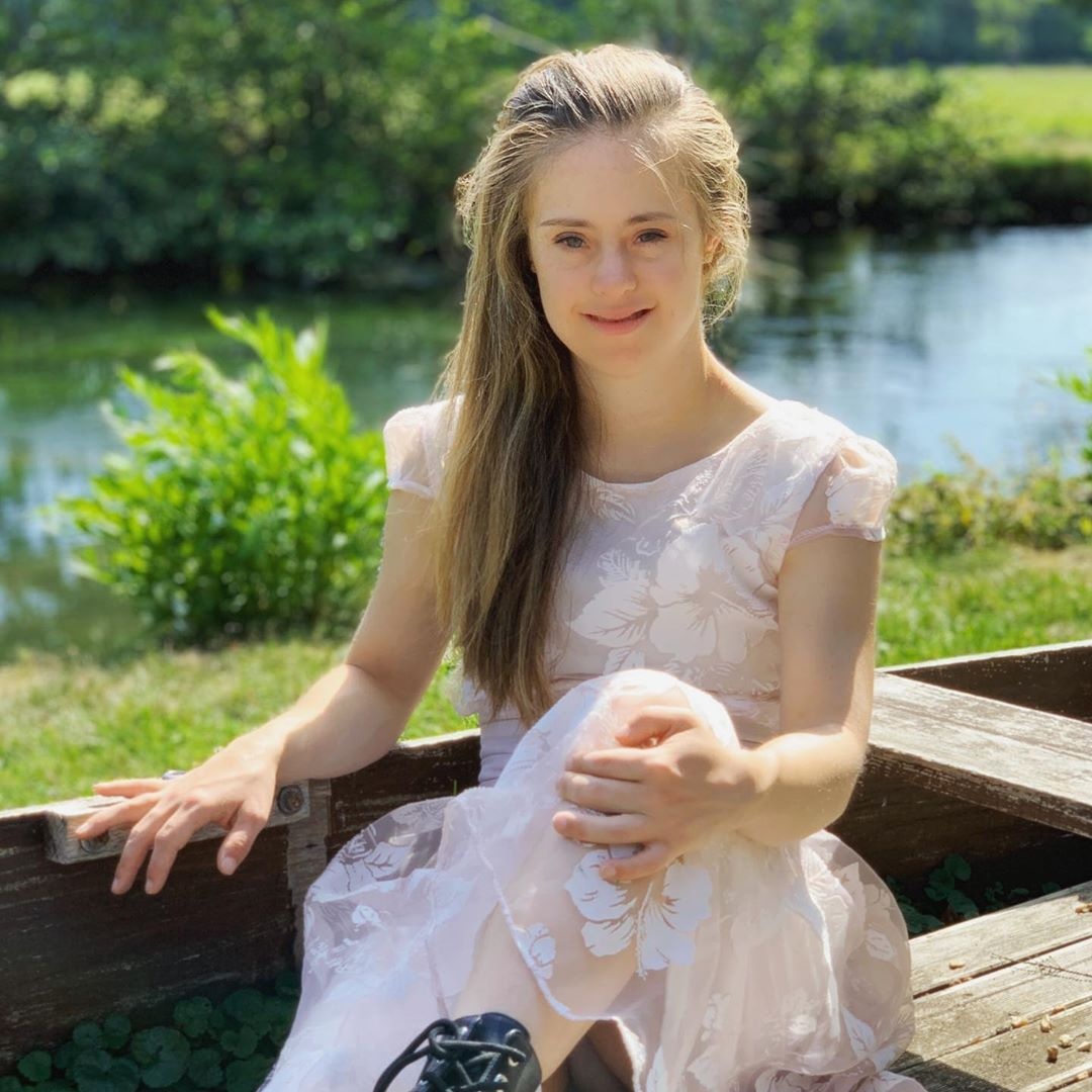 co gai mac benh down lam nguoi mau anh 4