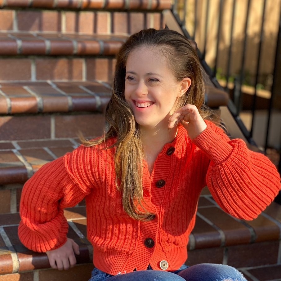 co gai mac benh down lam nguoi mau anh 2