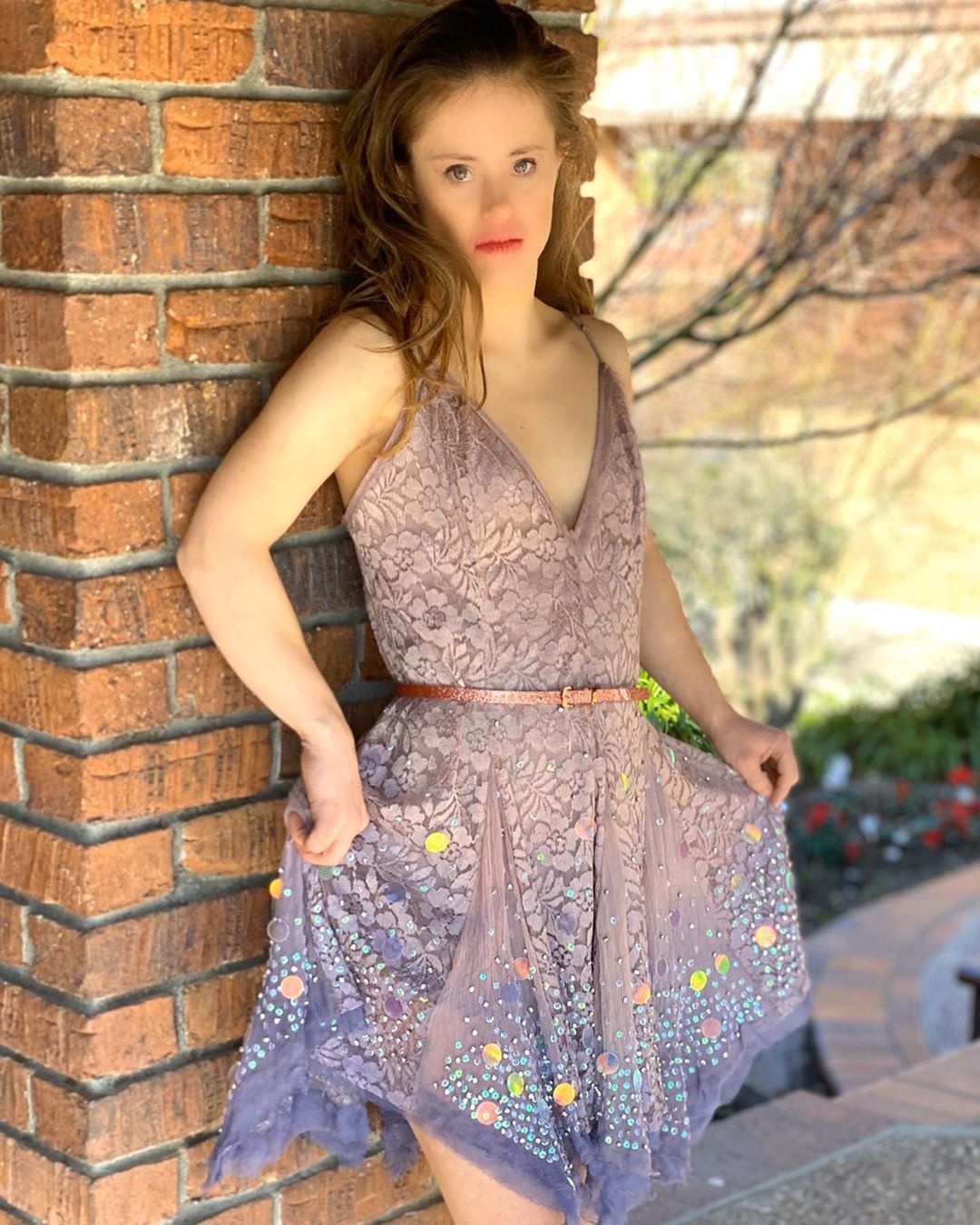 co gai mac benh down lam nguoi mau anh 8