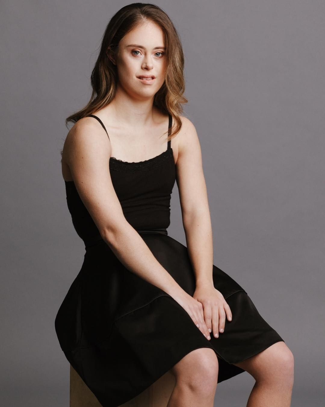 co gai mac benh down lam nguoi mau anh 7