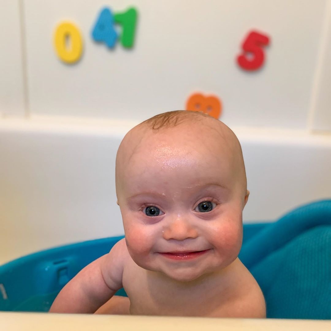 be trai bi down lam mau anh anh 3