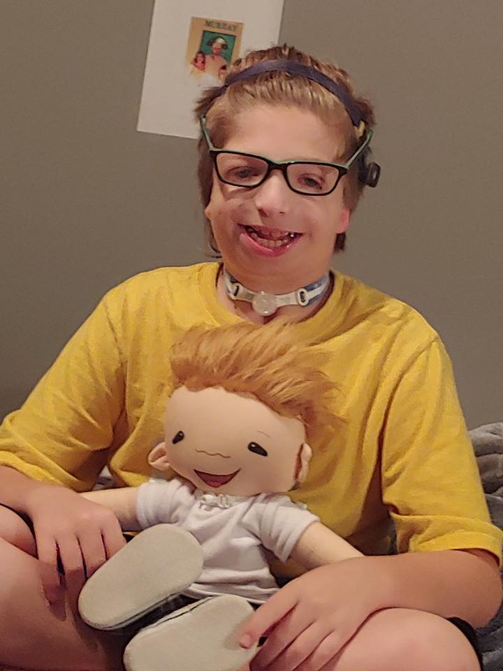 bup be cho tre khuyet tat anh 4