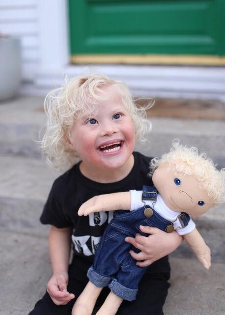 bup be cho tre khuyet tat anh 3