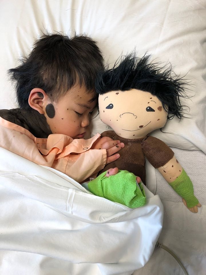 bup be cho tre khuyet tat anh 8