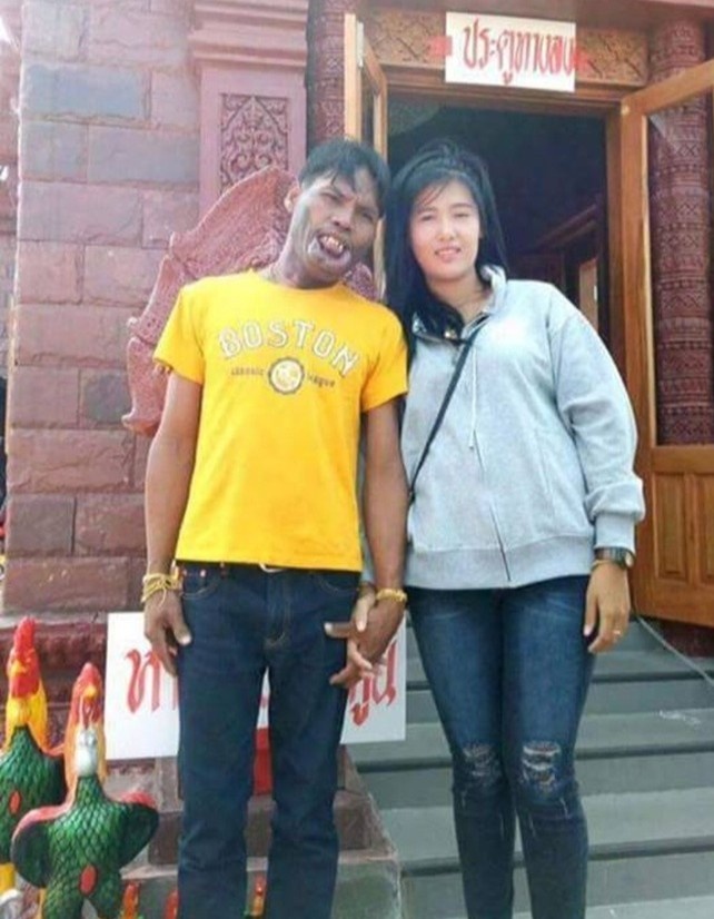 cô gái lấy chàng trai dị tật môi ảnh 6 co gai lay chang trai di tat moi anh 6
