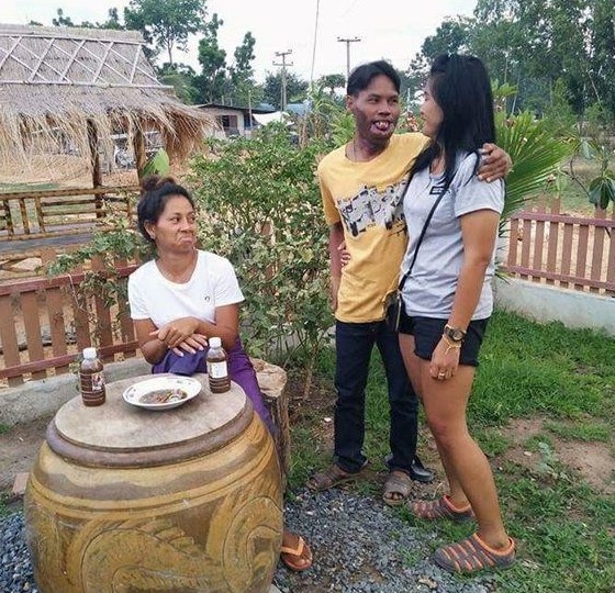cô gái lấy chàng trai dị tật môi ảnh 3 co gai lay chang trai di tat moi anh 3