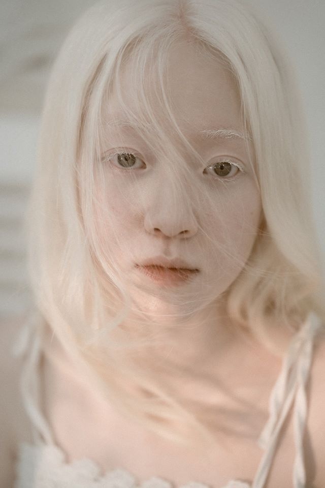 nữ sinh Hà Nội bạch tạng ảnh 9 nu sinh Ha Noi bach tang anh 9