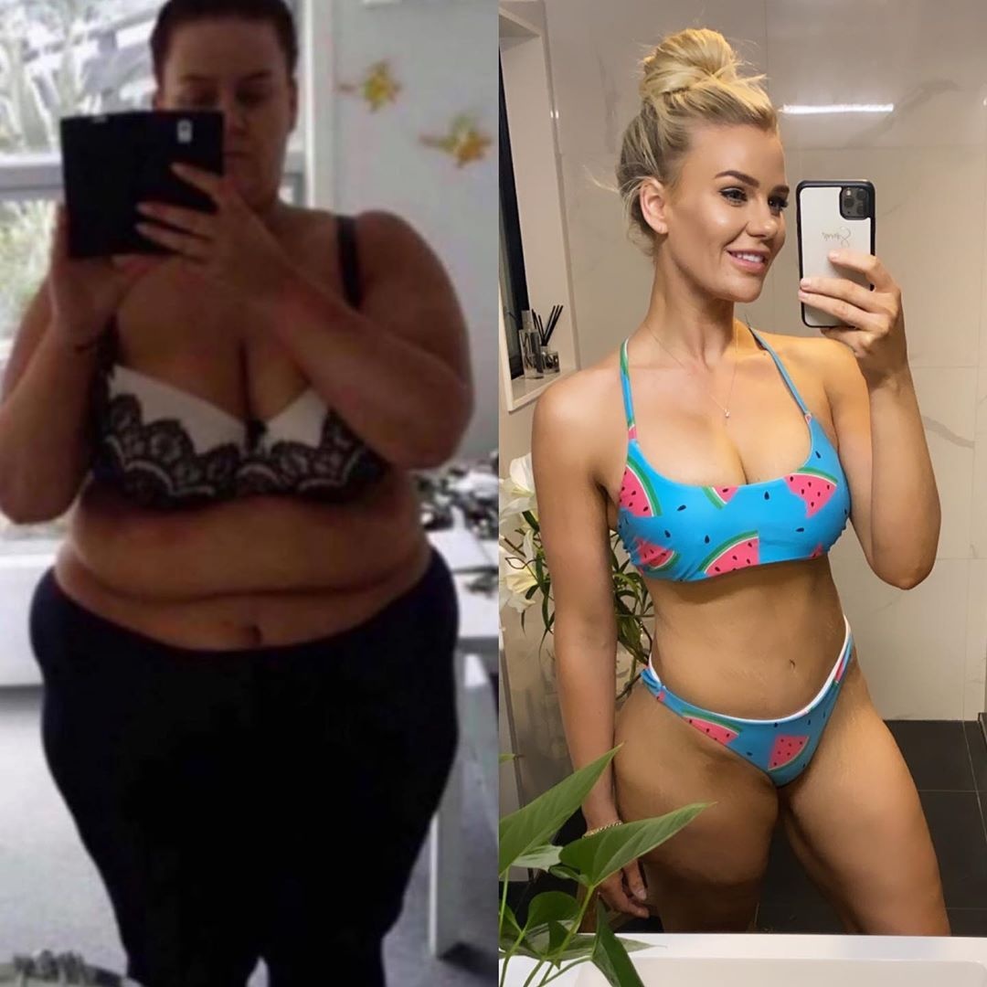 lột xác sau khi giảm 92 kg ảnh 2 lot xac sau khi giam 92 kg anh 2