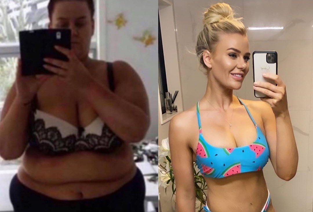 Co gai 'song cuoc doi khac' khi giam 92 kg va cat bo da thua hinh anh