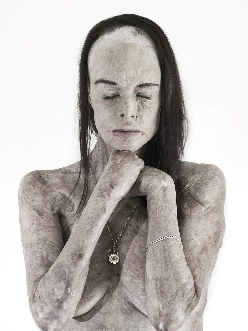 hoa hau bong 85% co the anh 2