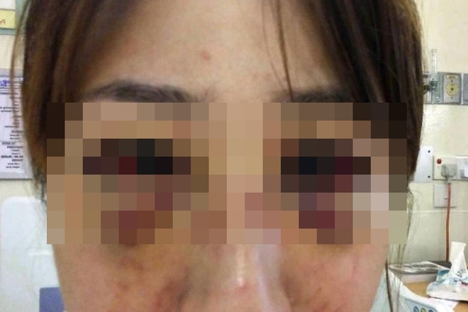 vao tu vi hanh hung ban gai anh 2