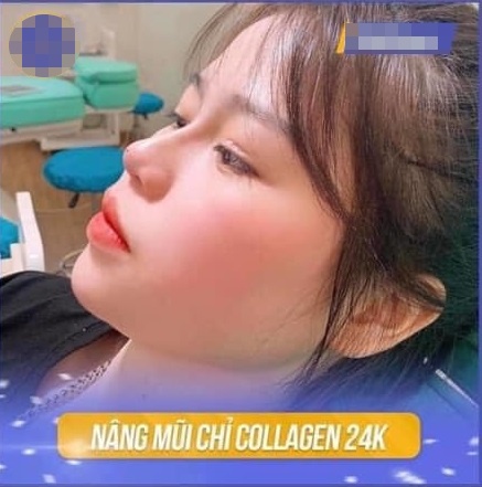 ban gai Quang Hai sua mui anh 1