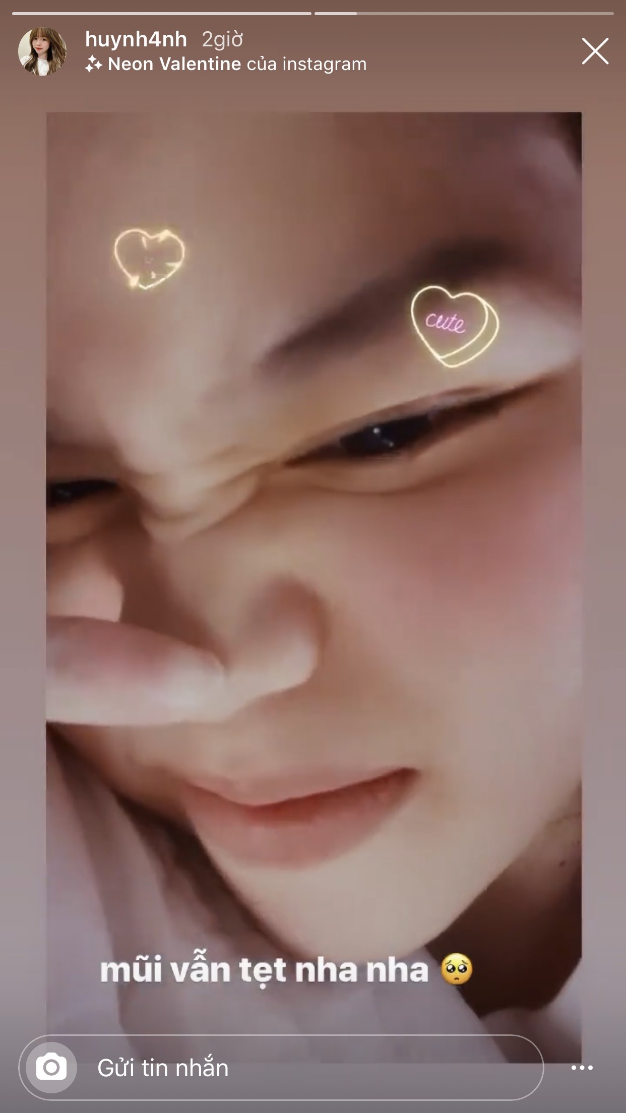 ban gai Quang Hai sua mui anh 2