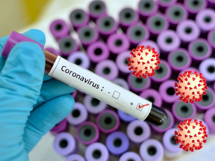 tu sat vi so mac covid-19 anh 1