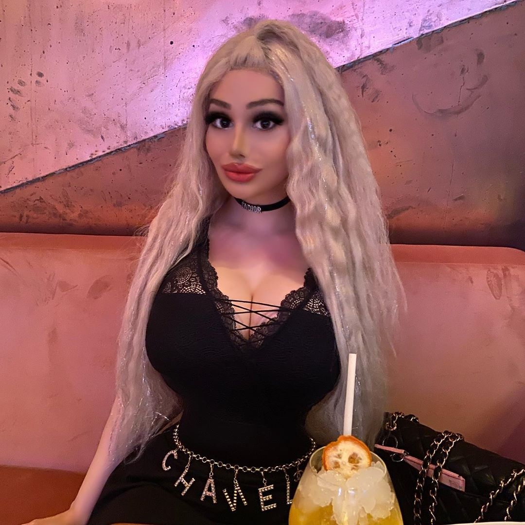 phau thuat 10 lan lam bup be song anh 1