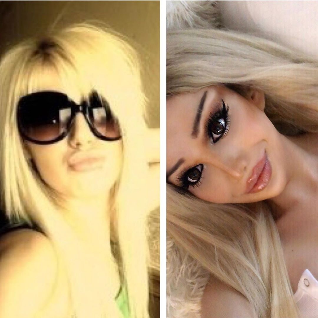 phau thuat 10 lan lam bup be song anh 7