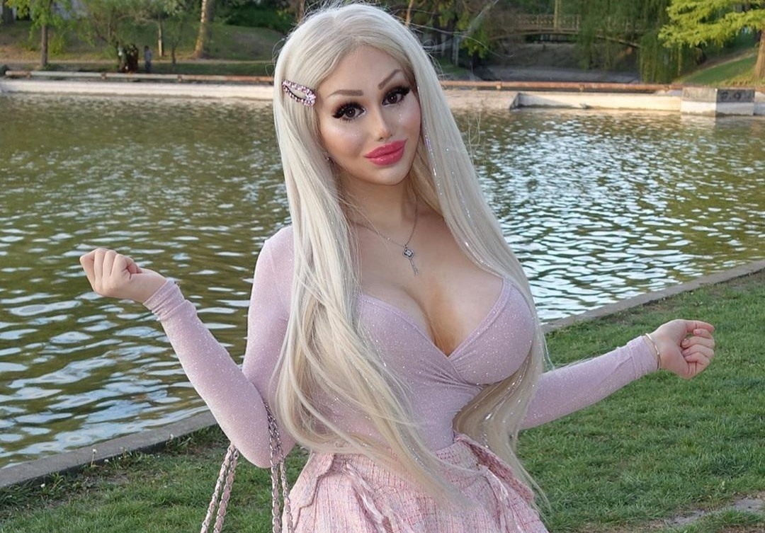 Co gai chi 170.000 USD, phau thuat 10 lan de giong 'bup be song' hinh anh