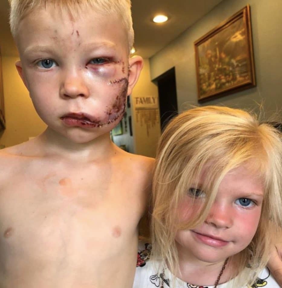 bao ve em gai khoi cho du anh 1