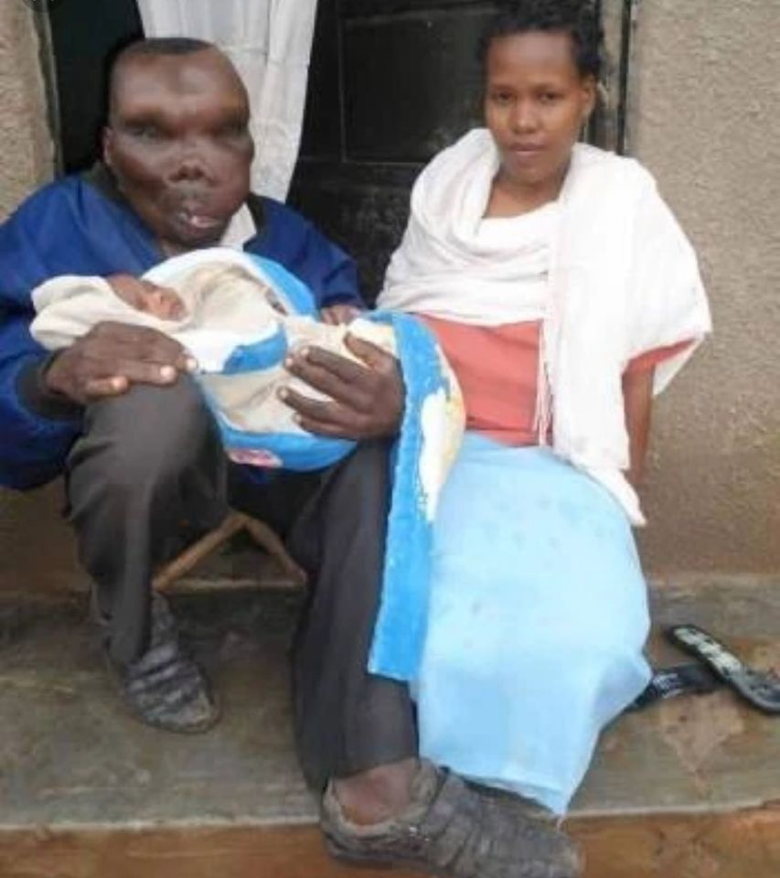 người đàn ông xấu xí nhất thế giới ảnh 4 nguoi dan ong xau xi nhat the gioi anh 4